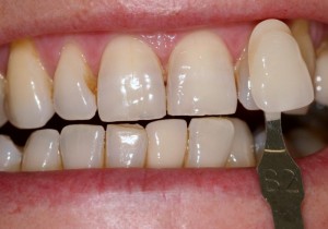 using Cosmetic Dentist 