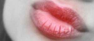 Lips after Procedure